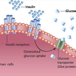 Diabetes Symptoms Quiz - Diabetes Mellitus Treatment - Keep Your Blood Glucose Level Normal